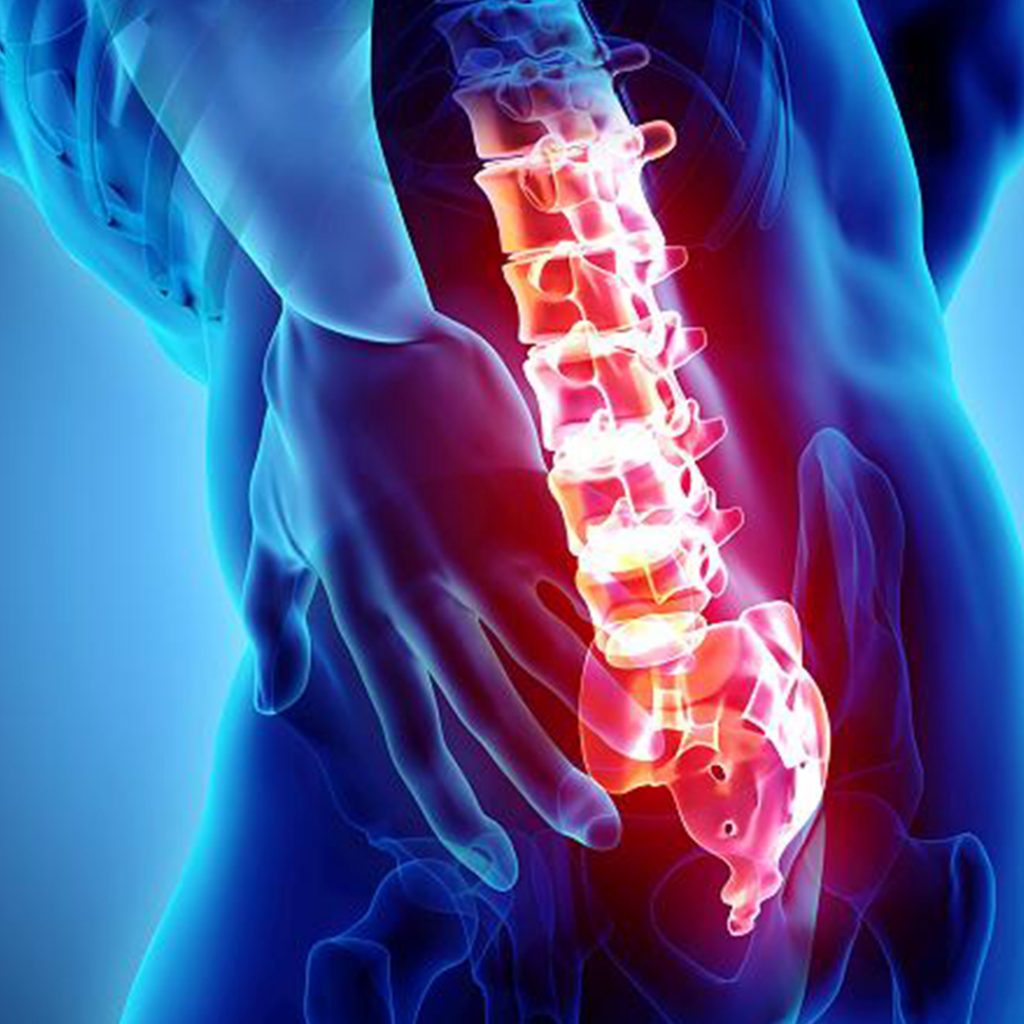 Rückenschmerzen: Gründe und Therapien